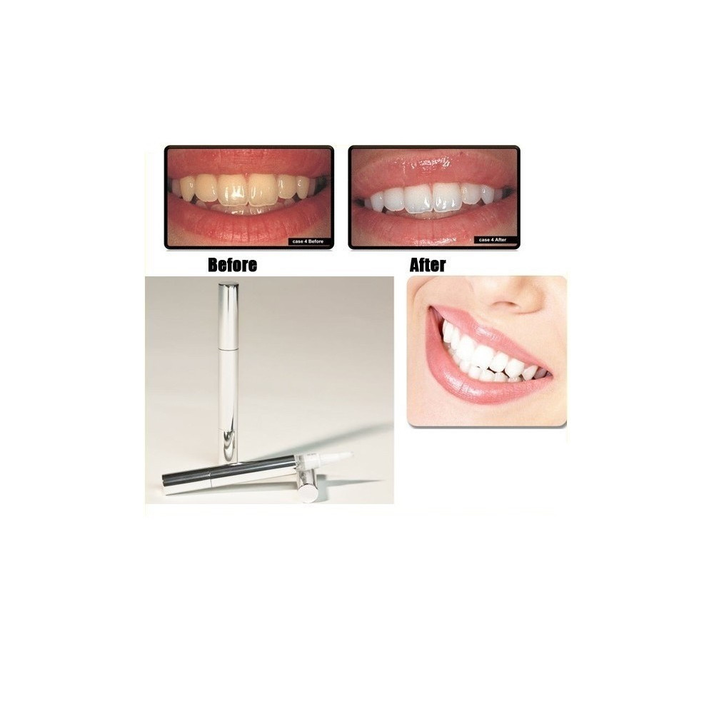 Teeth Whitening Pen Избелваща писалка за зъби - Image 2
