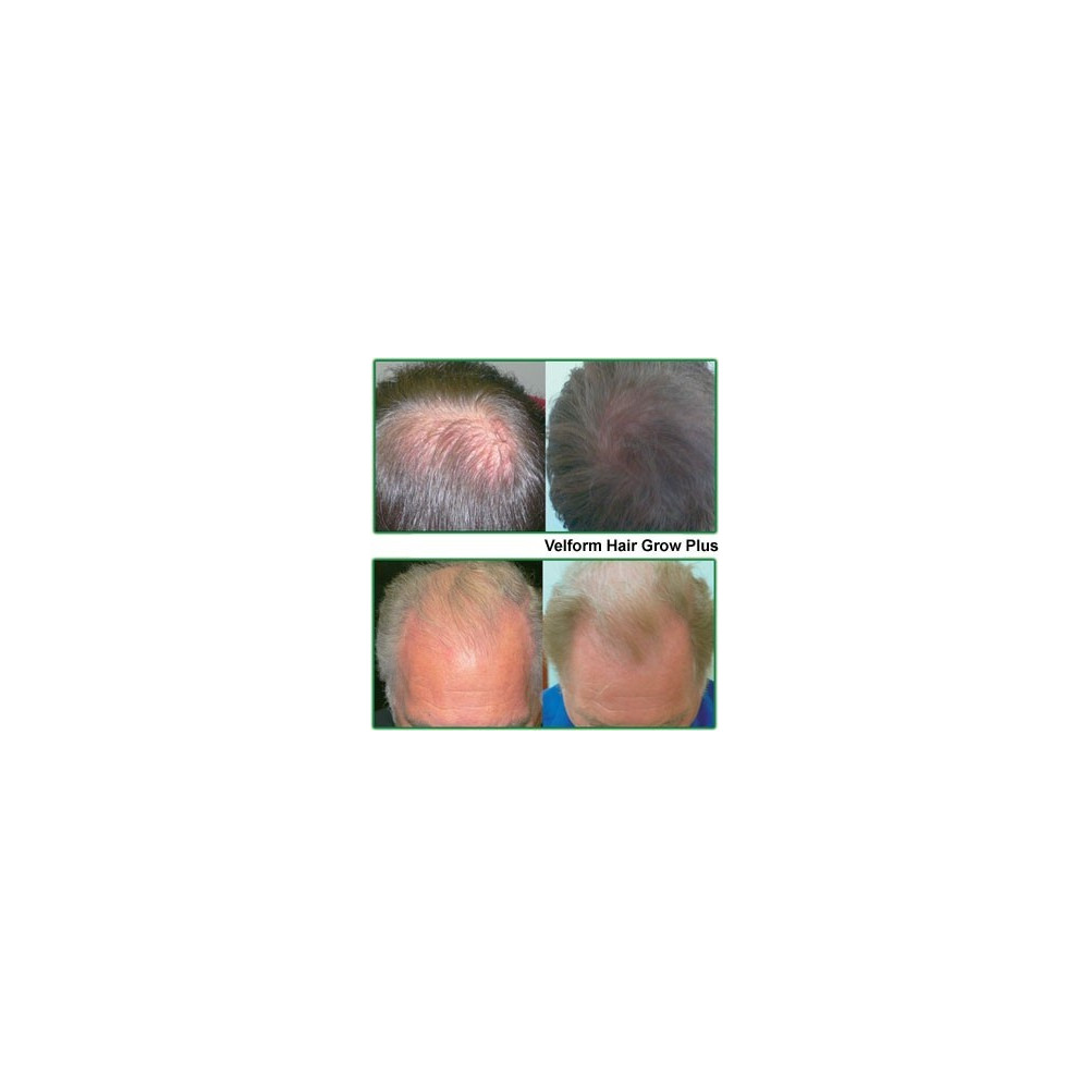Лазерна четка за коса Power Grow Comb - Image 5